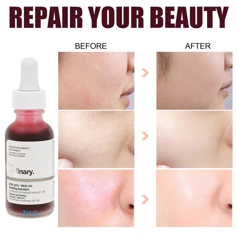 Ordinary Peeling Solution AHA 30% + BHA 2%